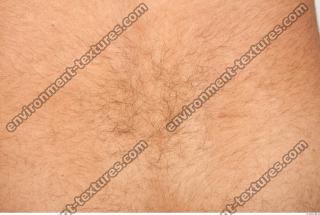 human skin hairy 0025